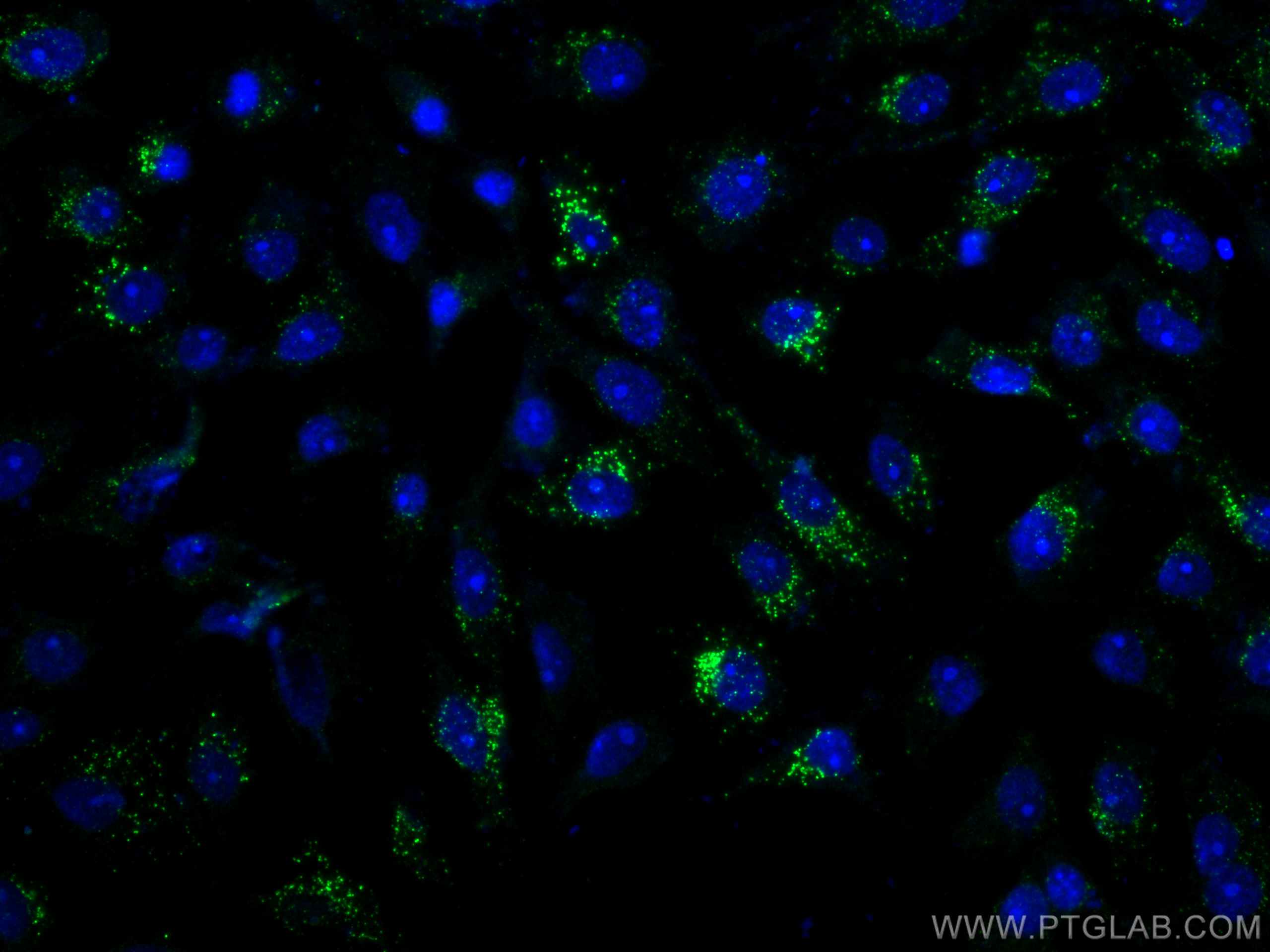 IF Staining of SH-SY5Y using 66496-1-Ig