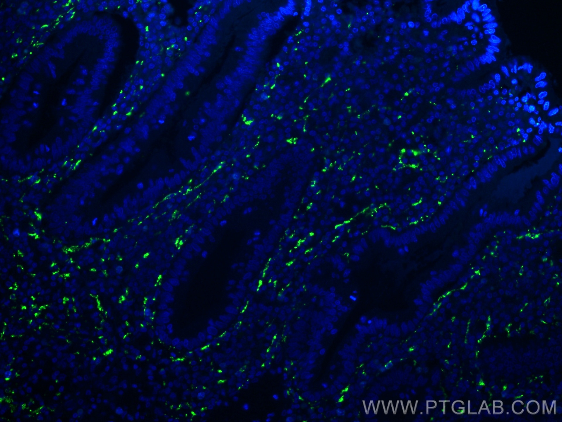 Immunofluorescence (IF) / fluorescent staining of human appendicitis tissue using Calretinin Monoclonal antibody (66496-1-Ig)