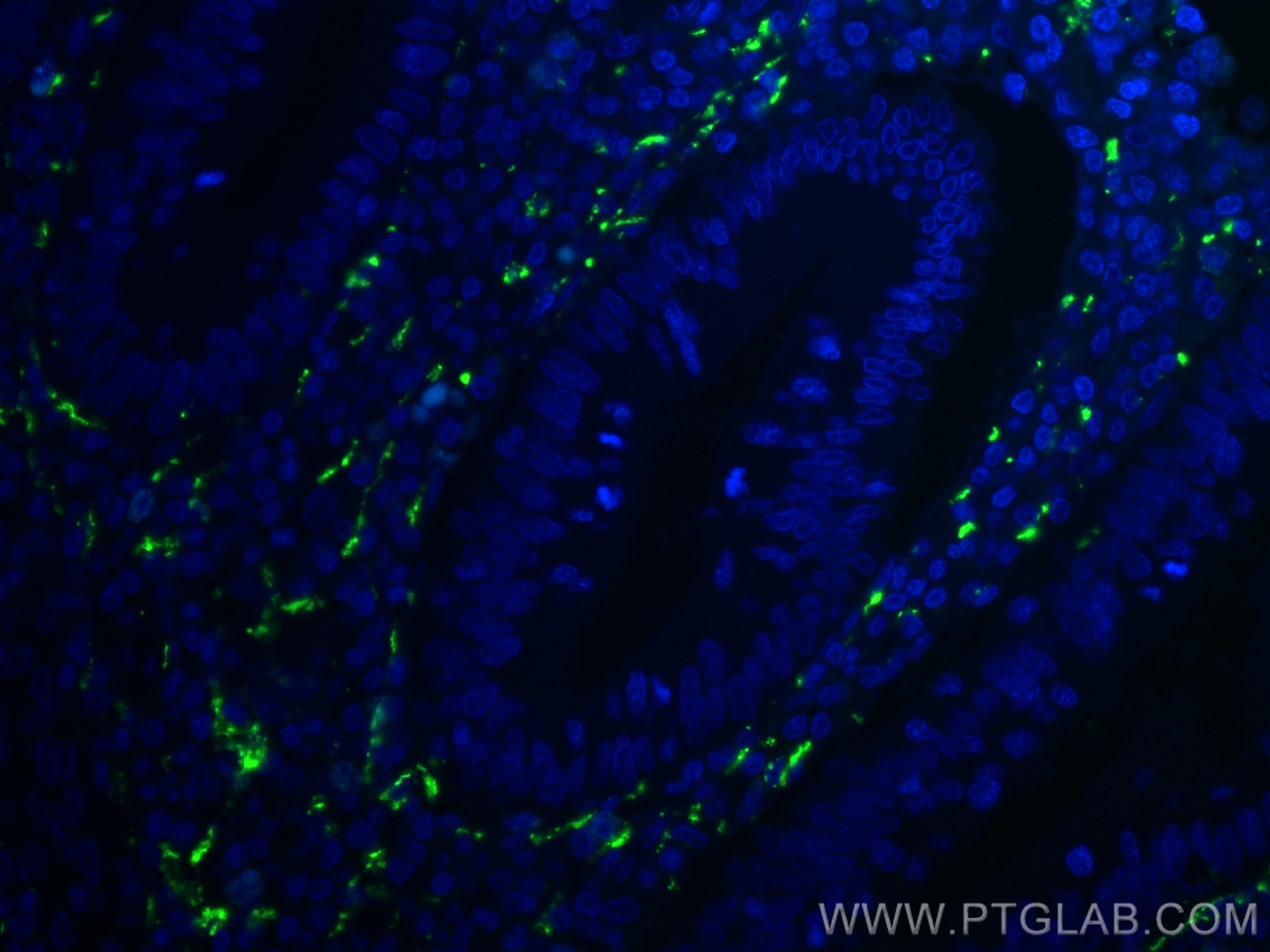 Immunofluorescence (IF) / fluorescent staining of human appendicitis tissue using Calretinin Monoclonal antibody (66496-1-Ig)