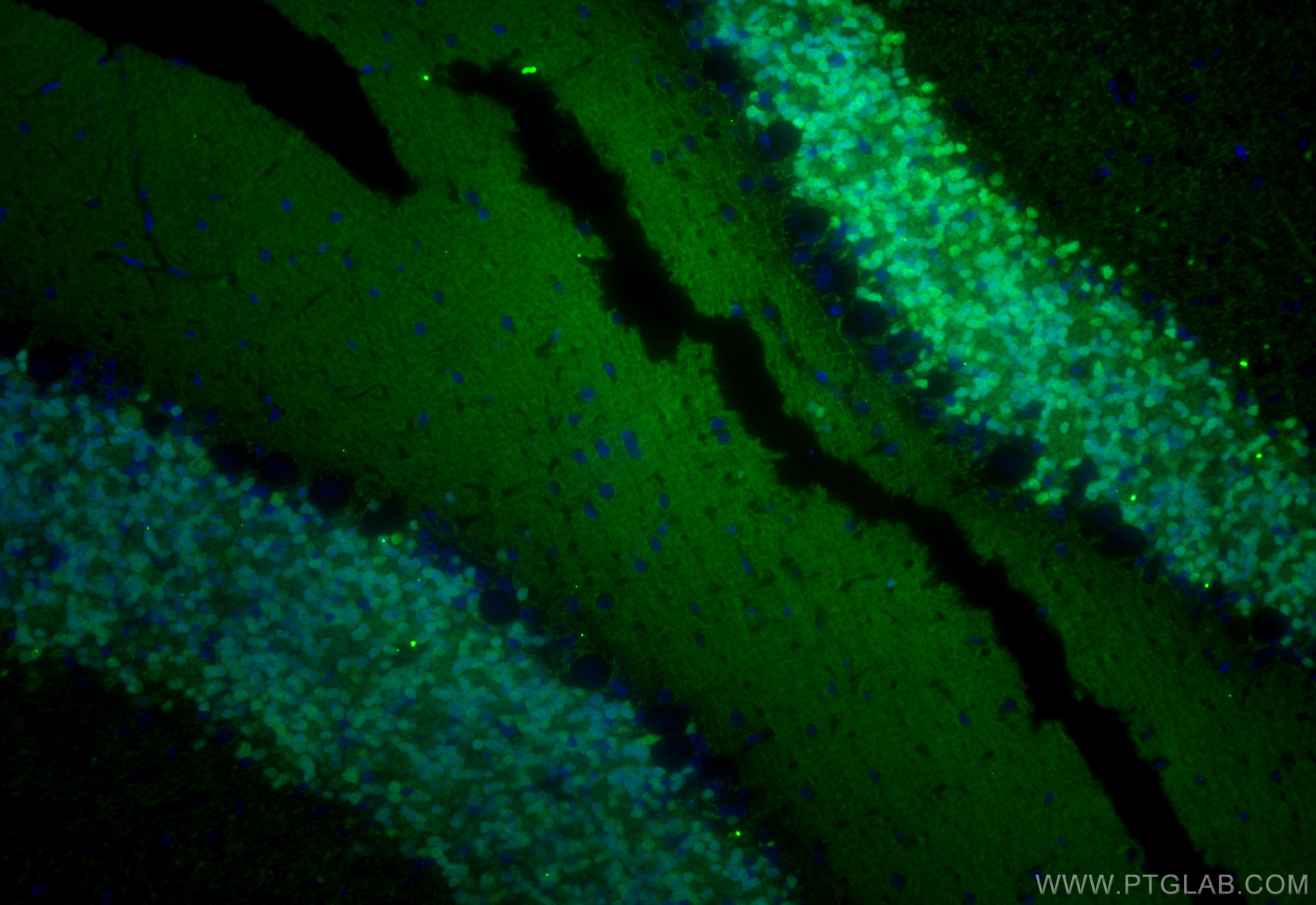 Immunofluorescence (IF) / fluorescent staining of rat cerebellum tissue using Calretinin Monoclonal antibody (66496-1-Ig)