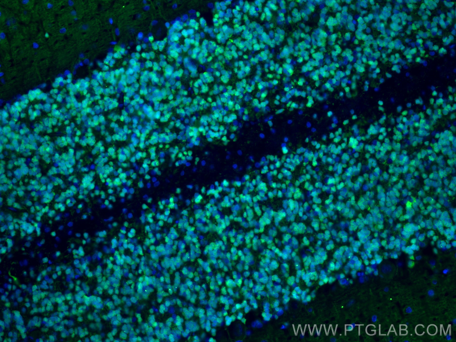 Immunofluorescence (IF) / fluorescent staining of rat cerebellum tissue using Calretinin Monoclonal antibody (66496-1-Ig)