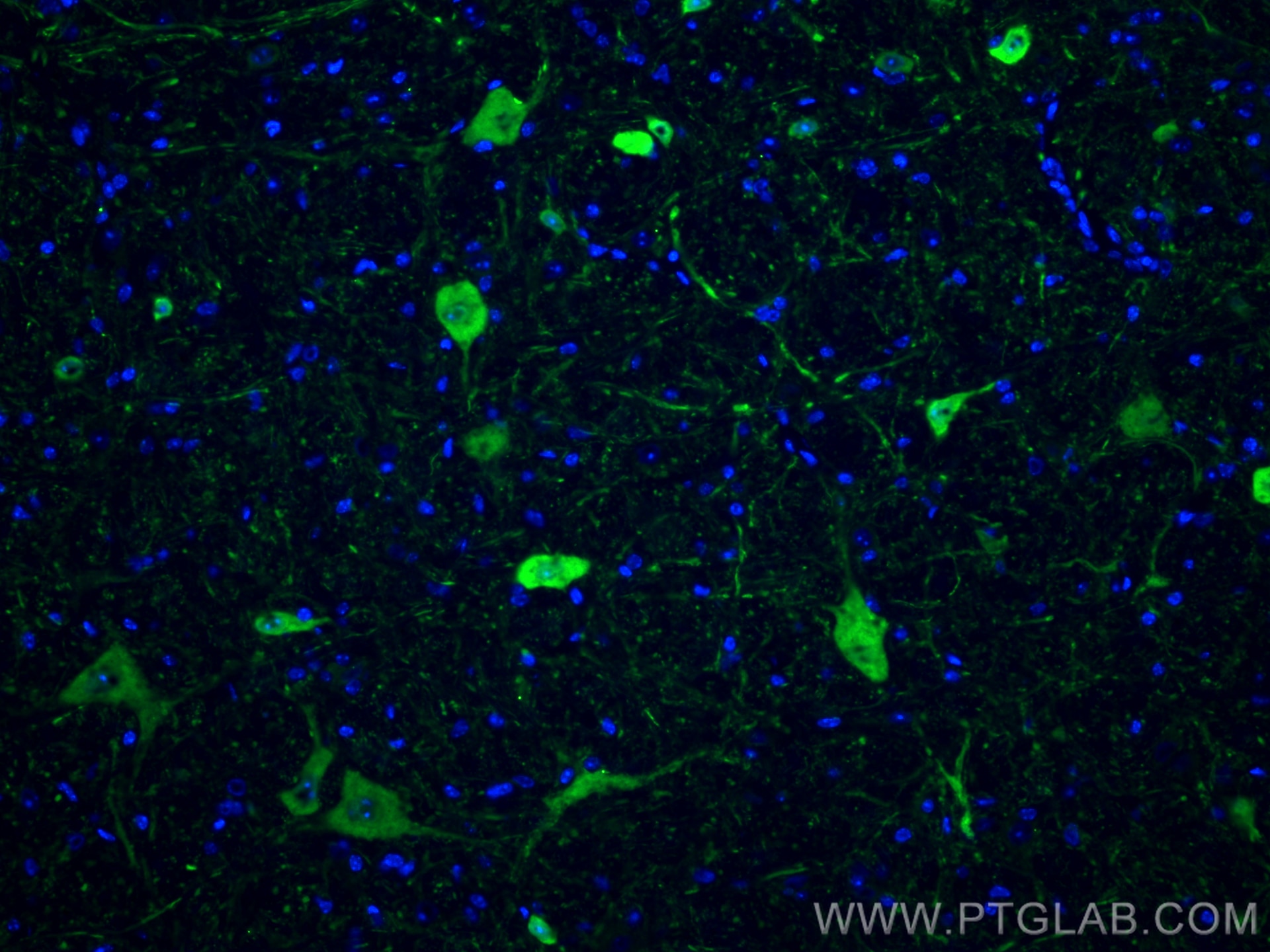 Immunofluorescence (IF) / fluorescent staining of mouse cerebellum tissue using Calretinin Monoclonal antibody (66496-1-Ig)
