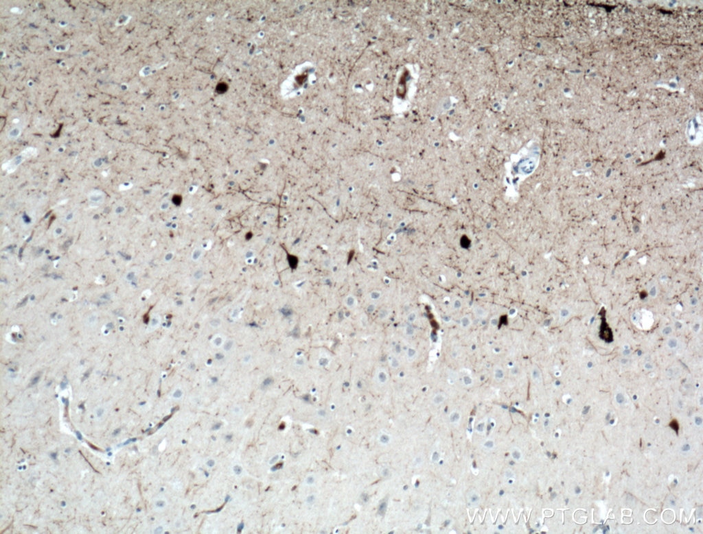 Immunohistochemistry (IHC) staining of human brain tissue using Calretinin Monoclonal antibody (66496-1-Ig)