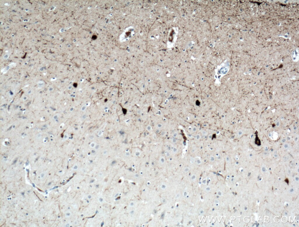 IHC staining of human brain using 66496-1-Ig