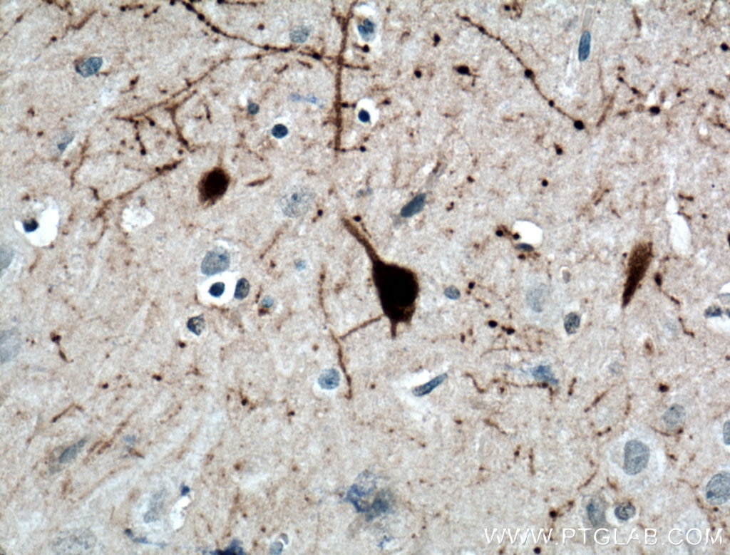 IHC staining of human brain using 66496-1-Ig
