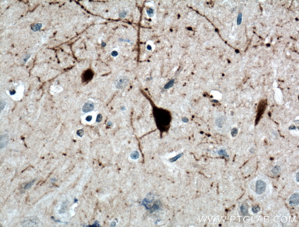 Immunohistochemistry (IHC) staining of human brain tissue using Calretinin Monoclonal antibody (66496-1-Ig)