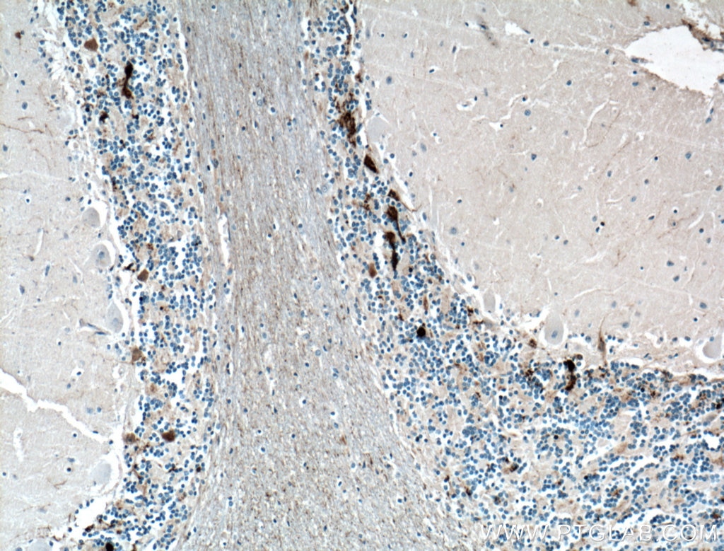 Immunohistochemistry (IHC) staining of human cerebellum tissue using Calretinin Monoclonal antibody (66496-1-Ig)