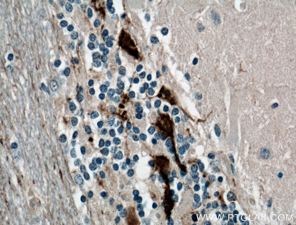 Immunohistochemistry (IHC) staining of human cerebellum tissue using Calretinin Monoclonal antibody (66496-1-Ig)