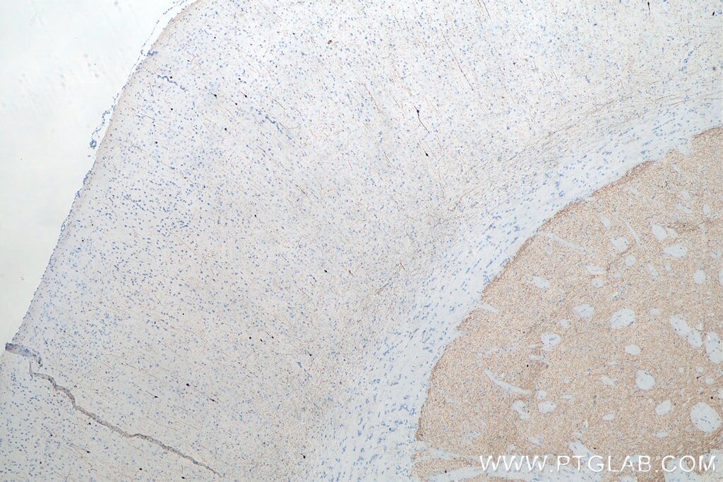 IHC staining of rat brain using 66496-1-Ig