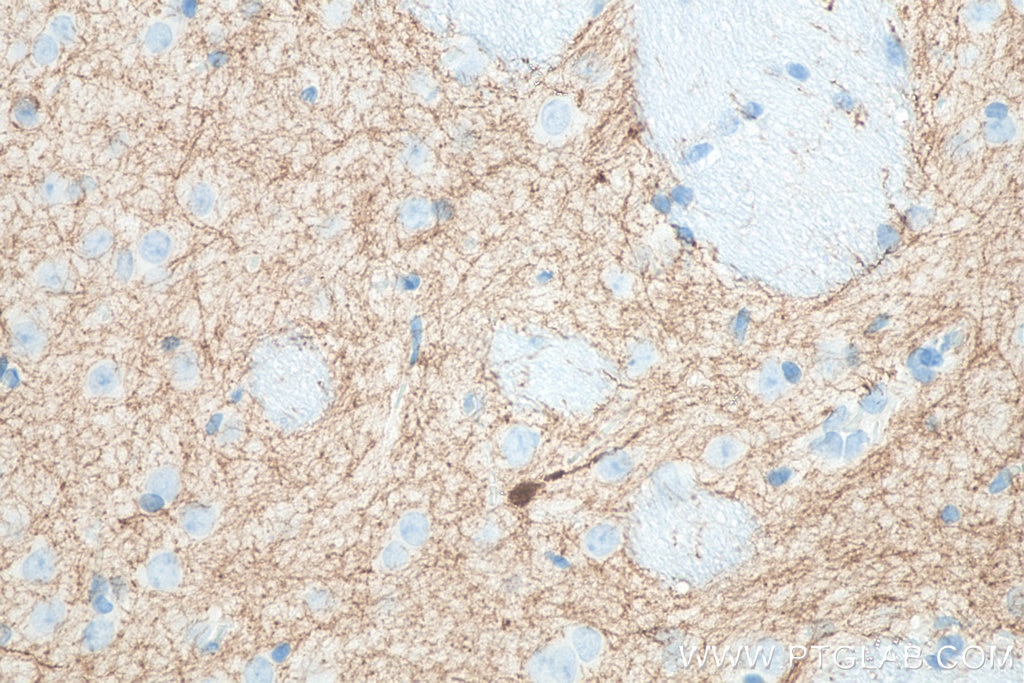 Immunohistochemistry (IHC) staining of rat brain tissue using Calretinin Monoclonal antibody (66496-1-Ig)