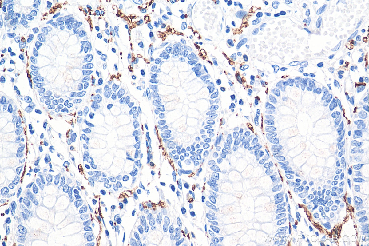 Immunohistochemistry (IHC) staining of human colon tissue using Calretinin Monoclonal antibody (66496-1-Ig)