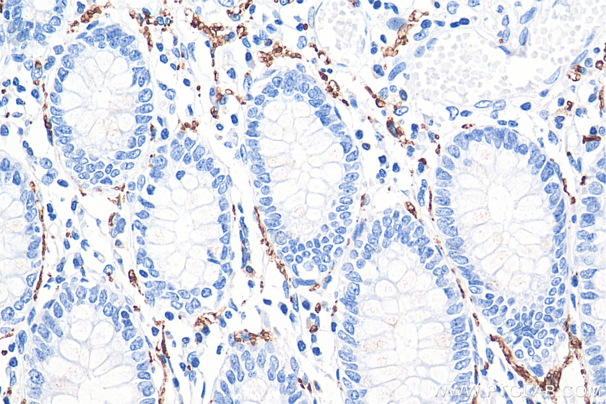 IHC staining of human colon using 66496-1-Ig