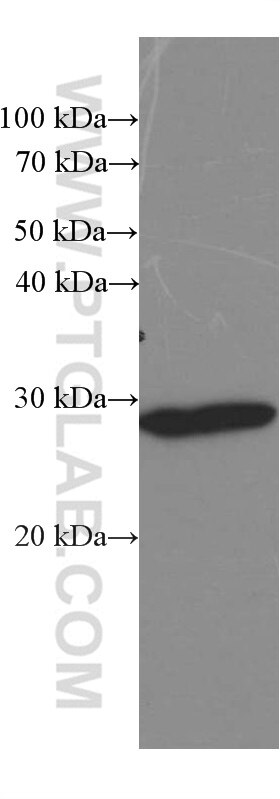 Western Blot (WB) analysis of mouse brain tissue using Calretinin Monoclonal antibody (66496-1-Ig)