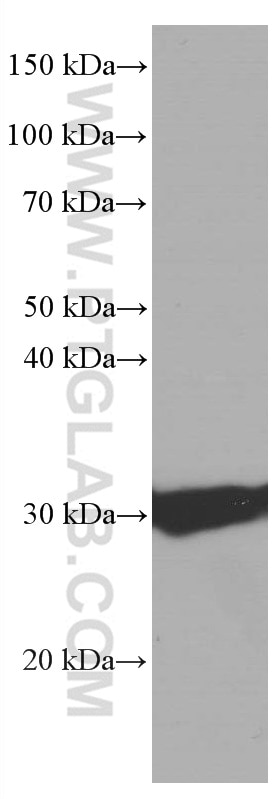 Western Blot (WB) analysis of rat brain tissue using Calretinin Monoclonal antibody (66496-1-Ig)