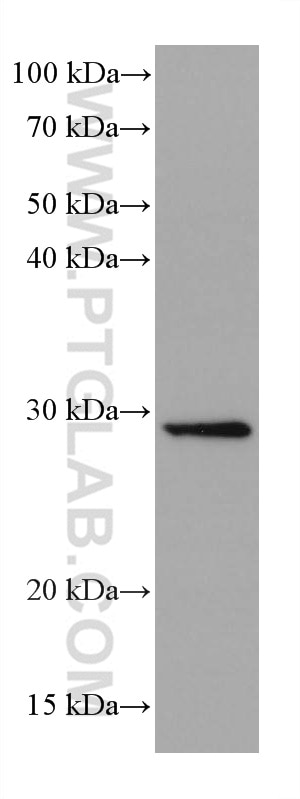 Western Blot (WB) analysis of U2OS cells using Calretinin Monoclonal antibody (66496-1-Ig)