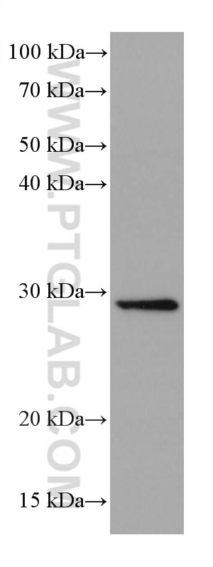WB analysis of U2OS using 66496-1-Ig