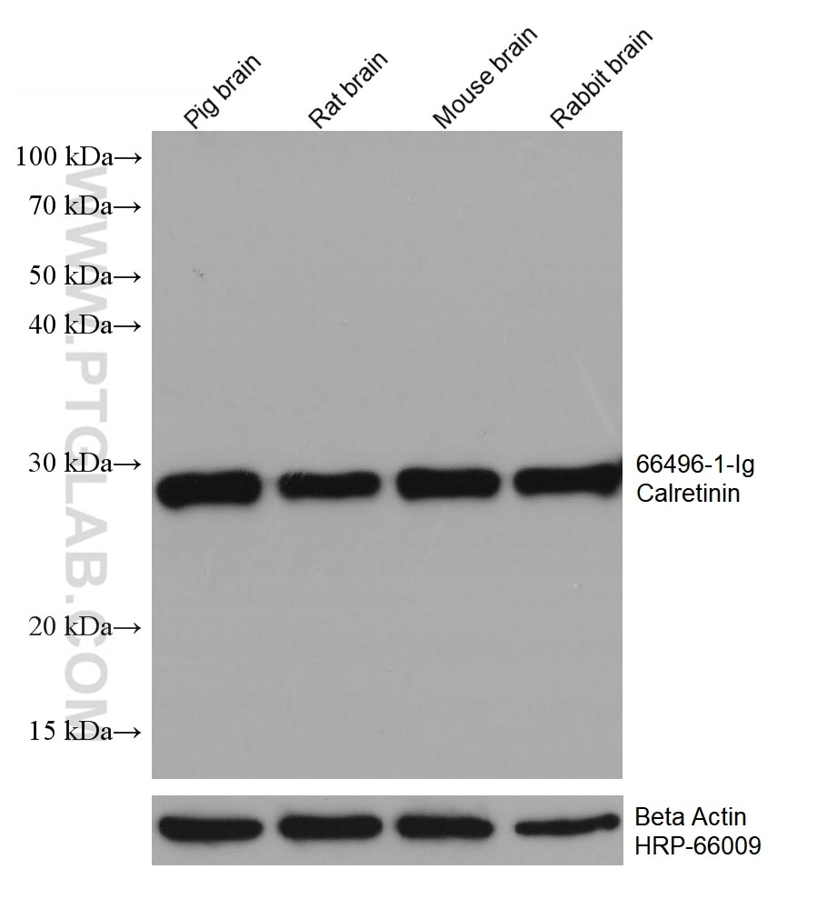 Western Blot (WB) analysis of various lysates using Calretinin Monoclonal antibody (66496-1-Ig)
