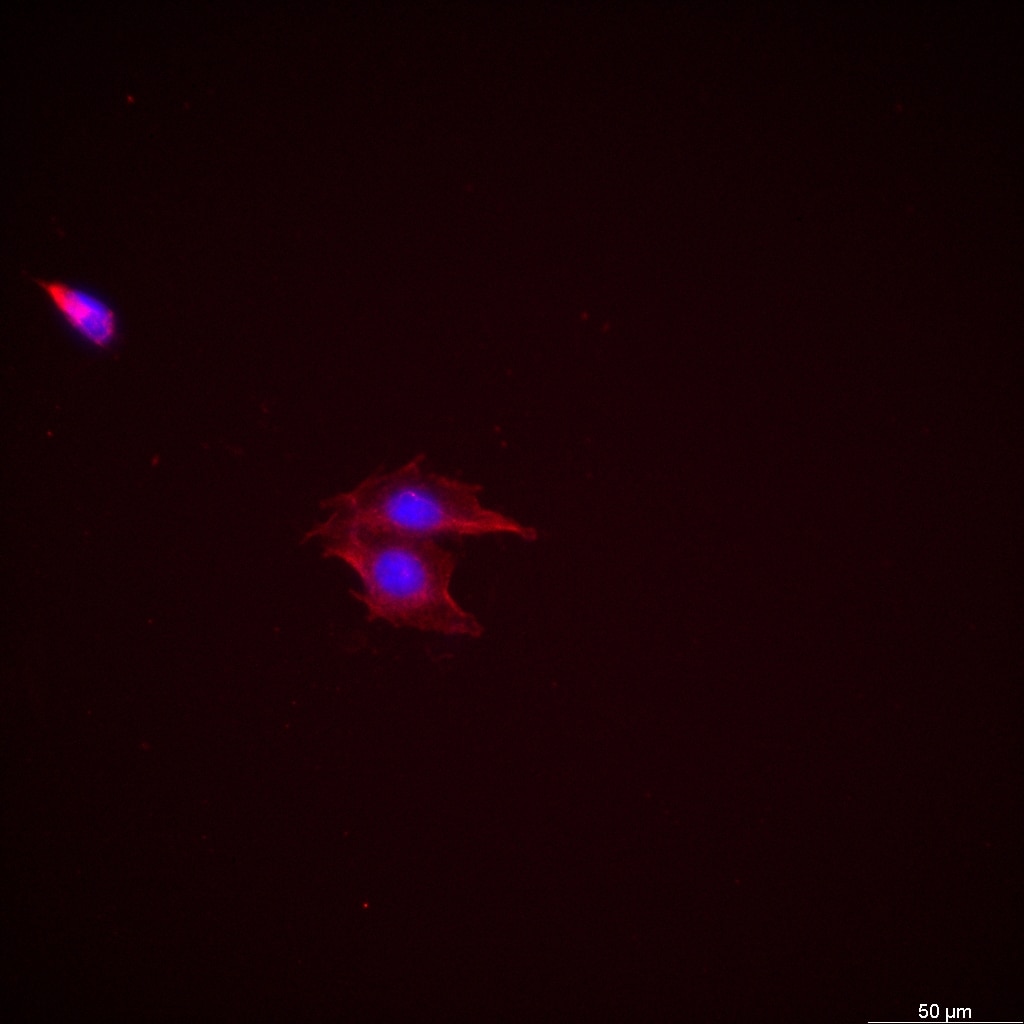 Immunofluorescence (IF) / fluorescent staining of SH-SY5Y cells using Calretinin Recombinant antibody (82811-1-RR)