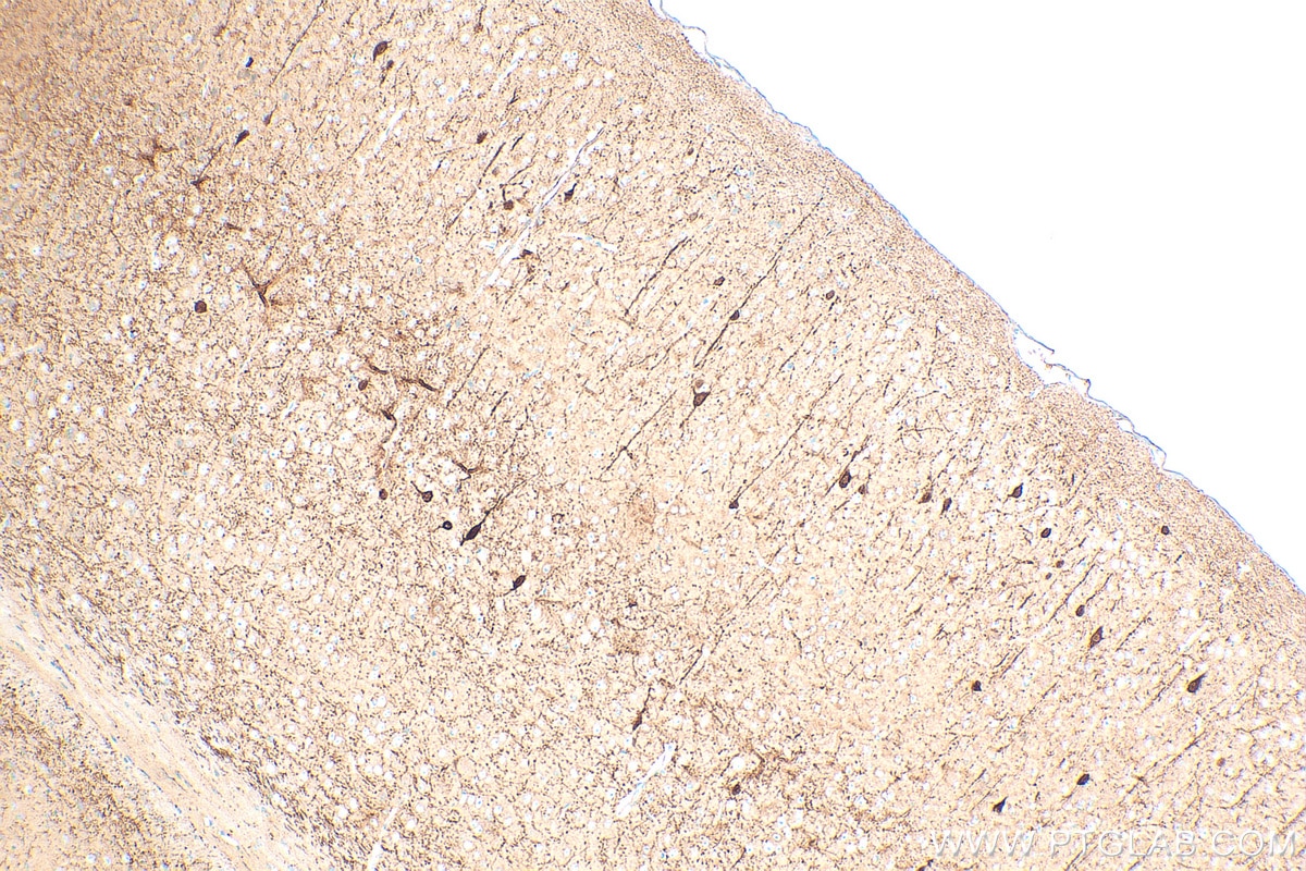IHC staining of mouse brain using 82811-1-RR