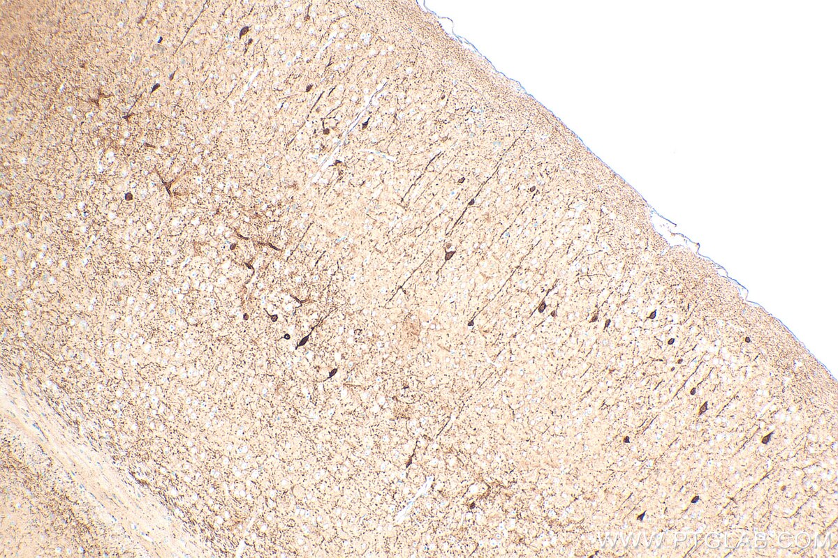 Immunohistochemistry (IHC) staining of mouse brain tissue using Calretinin Recombinant antibody (82811-1-RR)