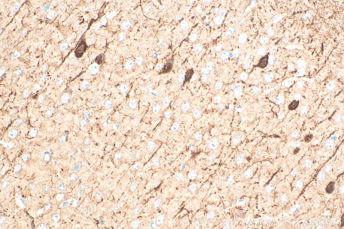 Immunohistochemistry (IHC) staining of mouse brain tissue using Calretinin Recombinant antibody (82811-1-RR)