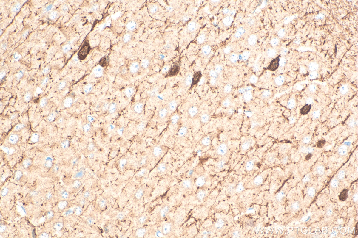 IHC staining of mouse brain using 82811-1-RR