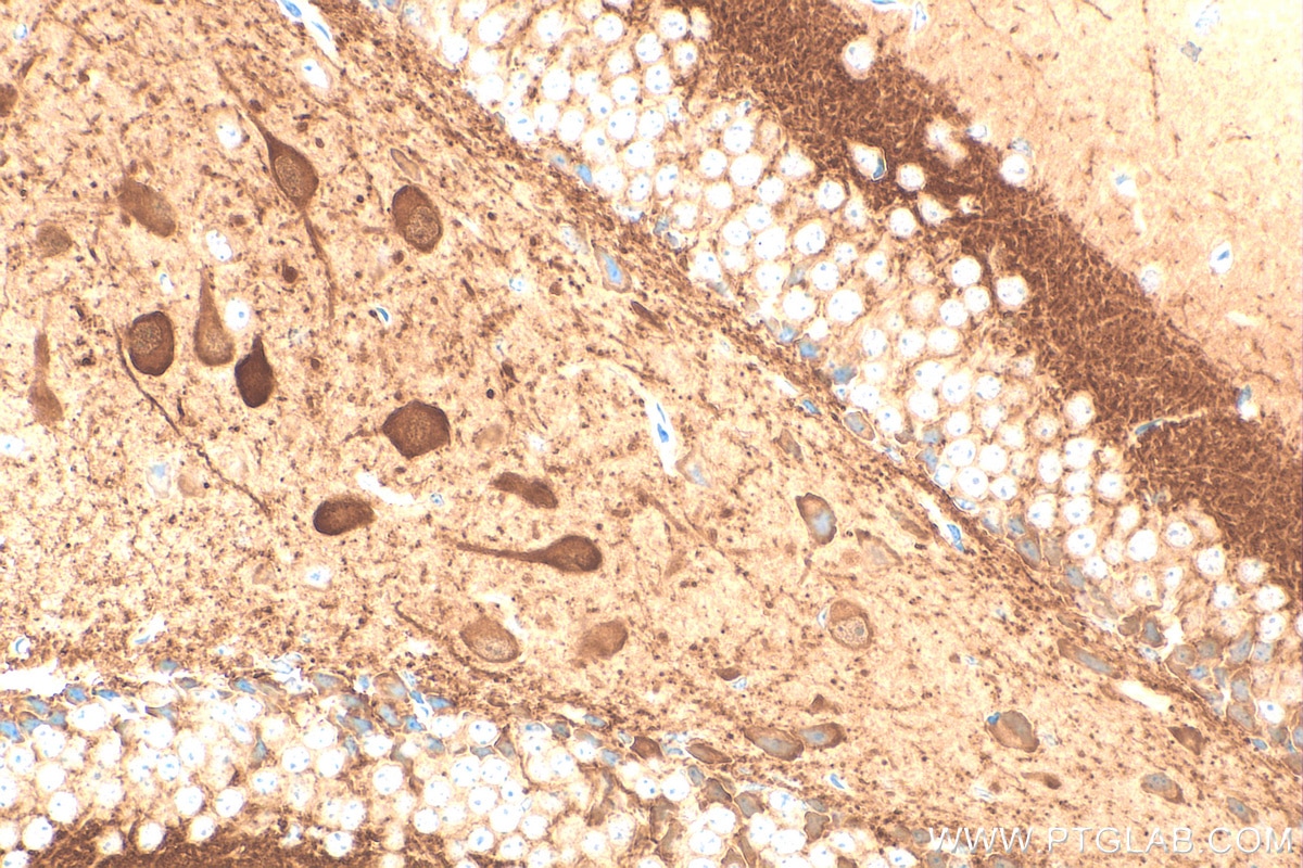 Immunohistochemistry (IHC) staining of mouse brain tissue using Calretinin Recombinant antibody (82811-1-RR)