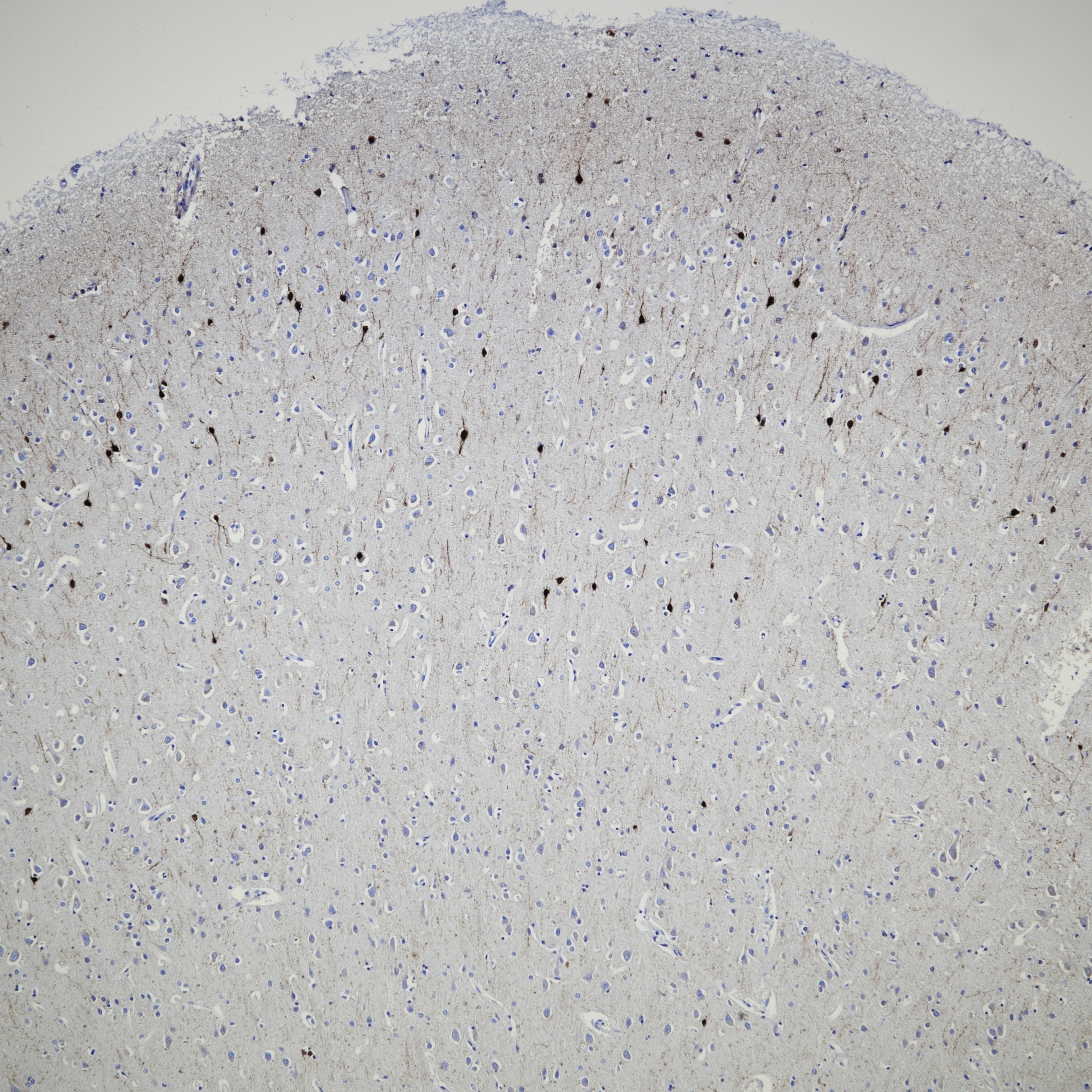 Immunohistochemistry (IHC) staining of human brain tissue using Calretinin Recombinant monoclonal antibody (82811-1-RR)
