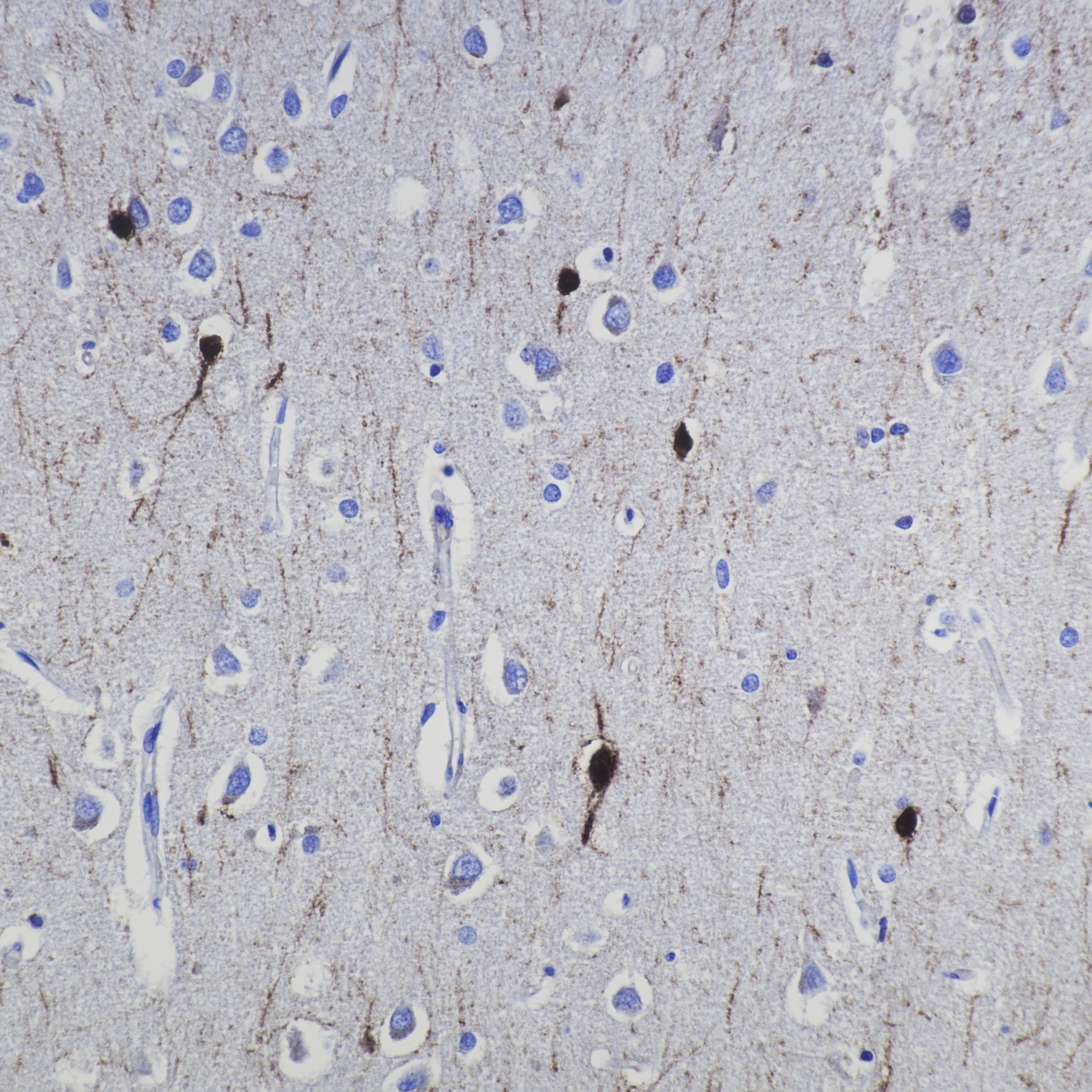 Immunohistochemistry (IHC) staining of human brain tissue using Calretinin Recombinant monoclonal antibody (82811-1-RR)