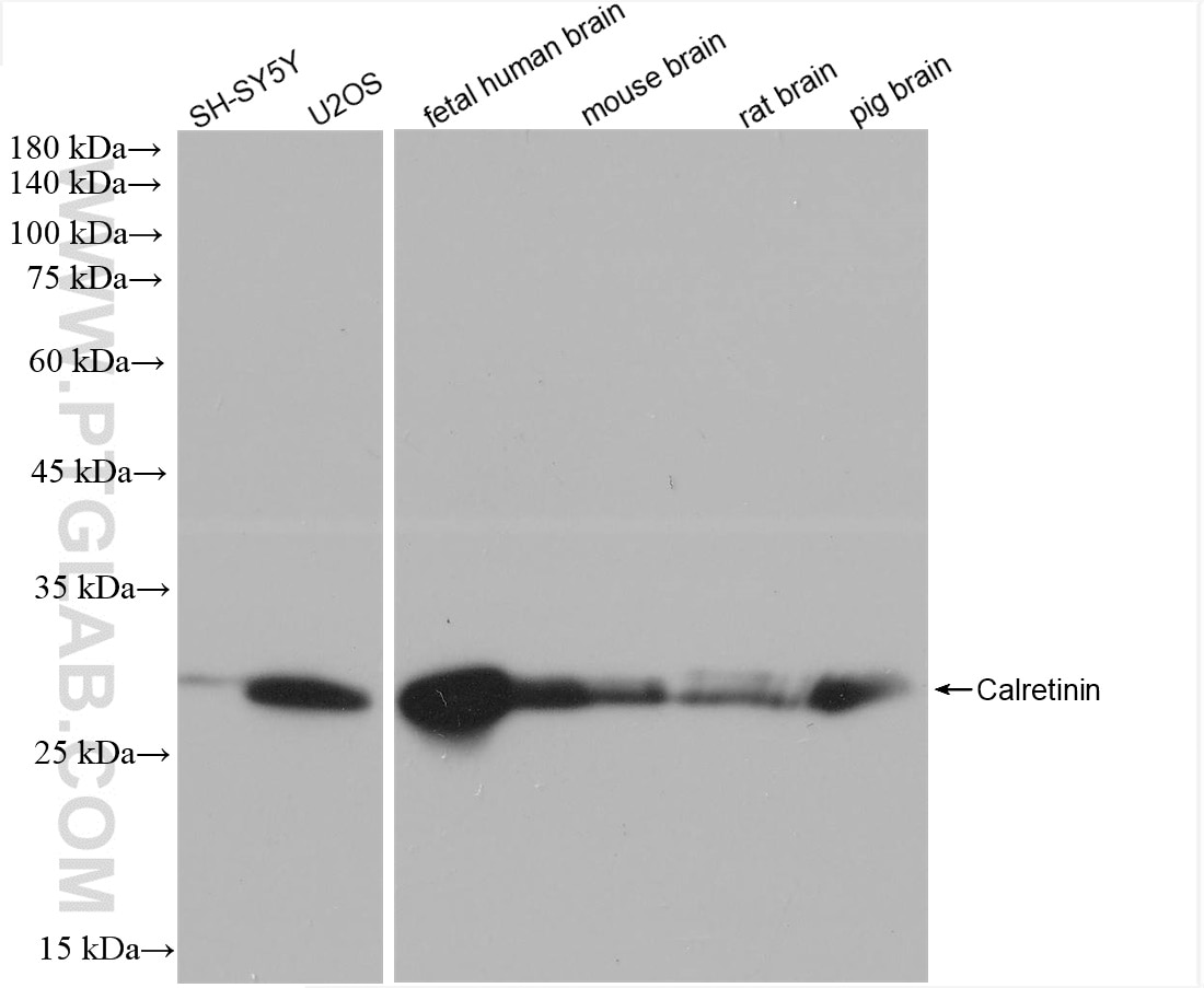 Western Blot (WB) analysis of various lysates using Calretinin Recombinant antibody (82811-1-RR)