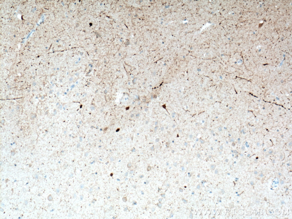Immunohistochemistry (IHC) staining of human brain tissue using Biotin-conjugated Calretinin Monoclonal antibody (Biotin-66496)