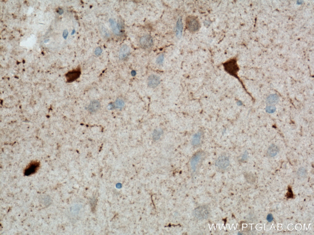 Immunohistochemistry (IHC) staining of human brain tissue using Biotin-conjugated Calretinin Monoclonal antibody (Biotin-66496)