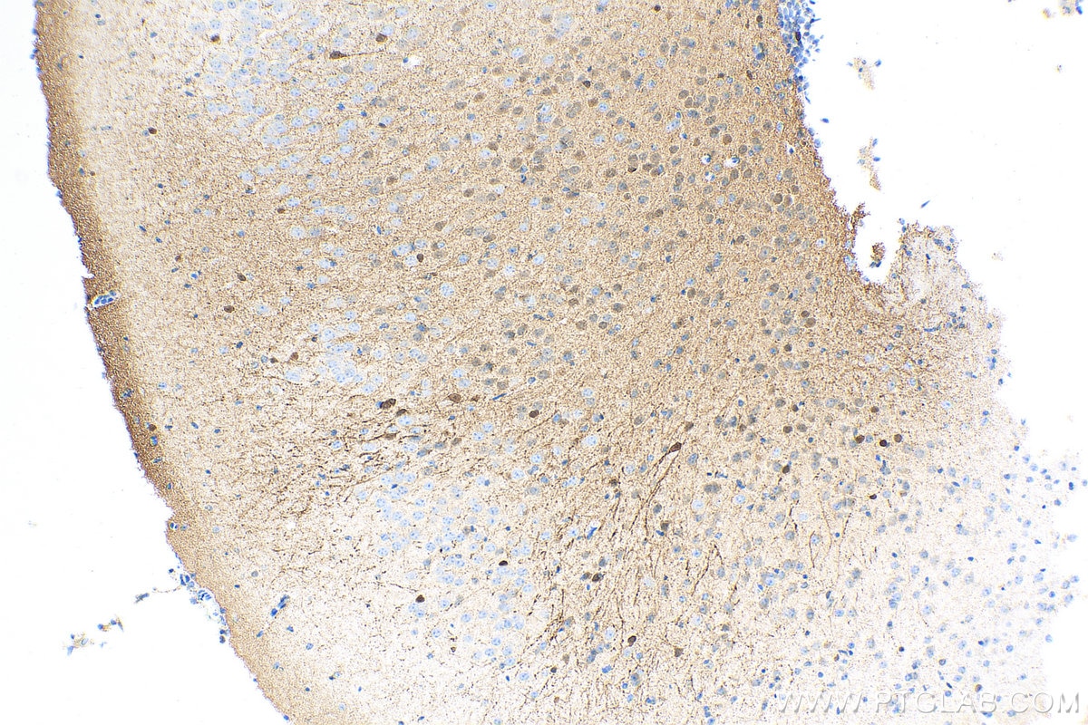 Immunohistochemistry (IHC) staining of mouse brain tissue using Biotin-conjugated Calretinin Monoclonal antibody (Biotin-66496)