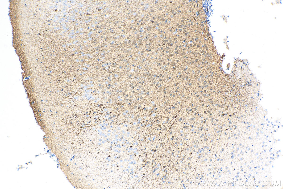 IHC staining of mouse brain using Biotin-66496