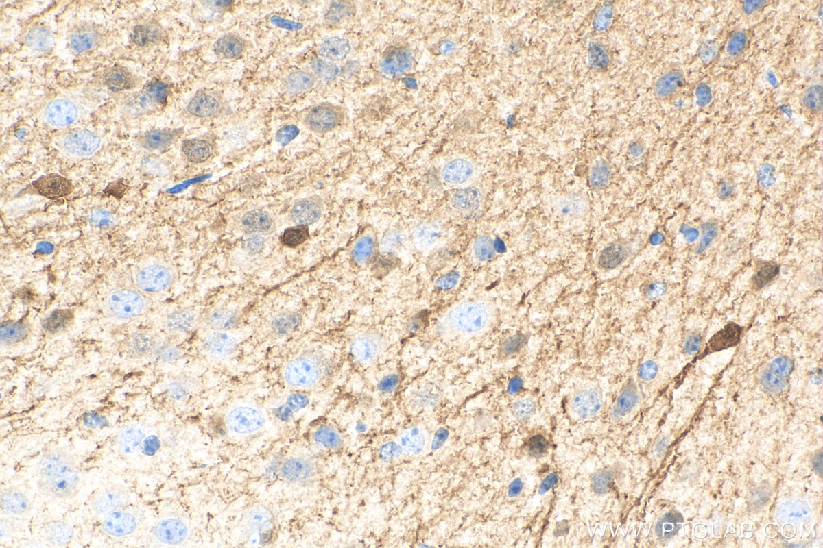 Immunohistochemistry (IHC) staining of mouse brain tissue using Biotin-conjugated Calretinin Monoclonal antibody (Biotin-66496)