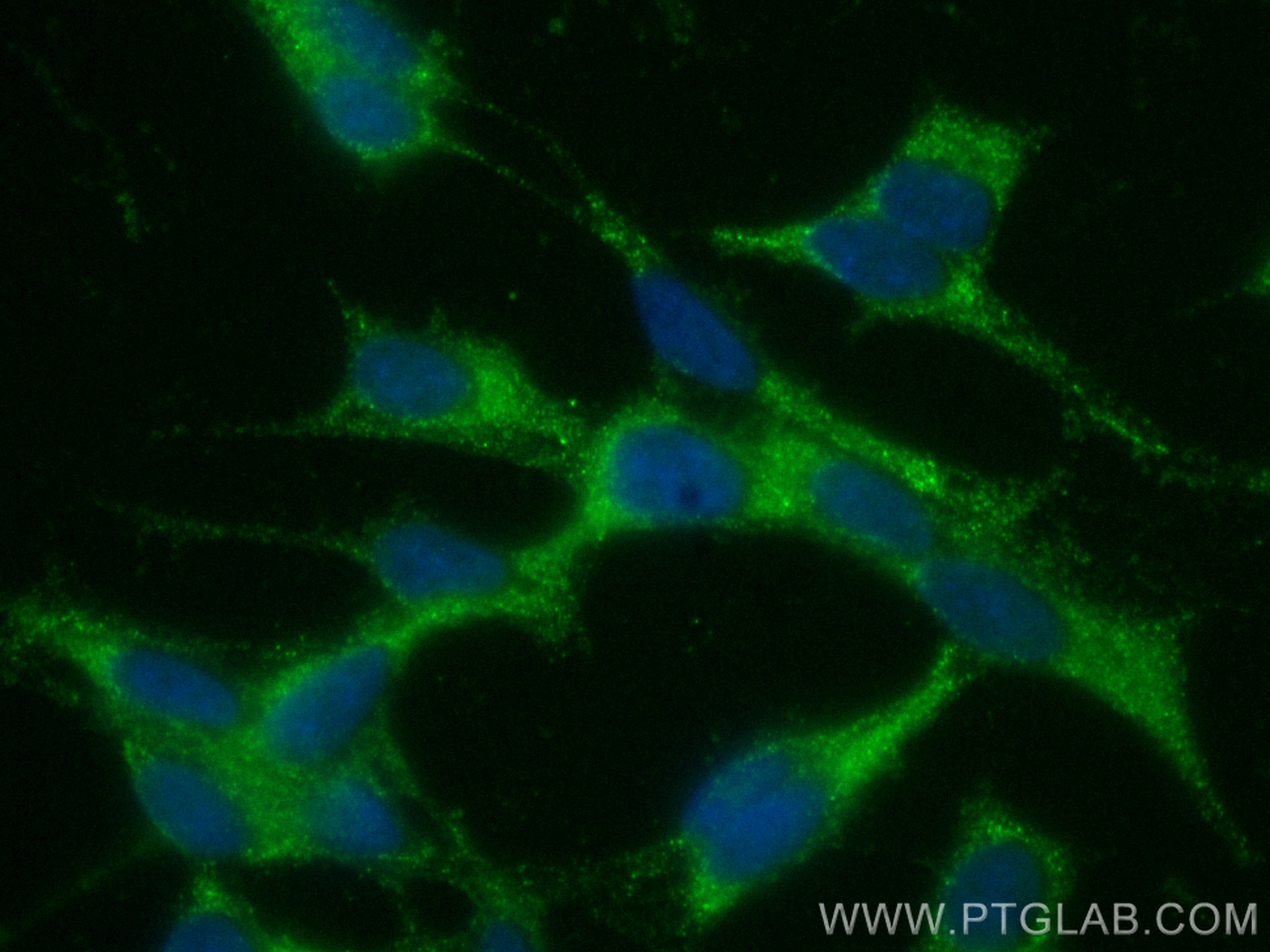 Immunofluorescence (IF) / fluorescent staining of SH-SY5Y cells using CoraLite® Plus 488-conjugated Calretinin Monoclona (CL488-66496)
