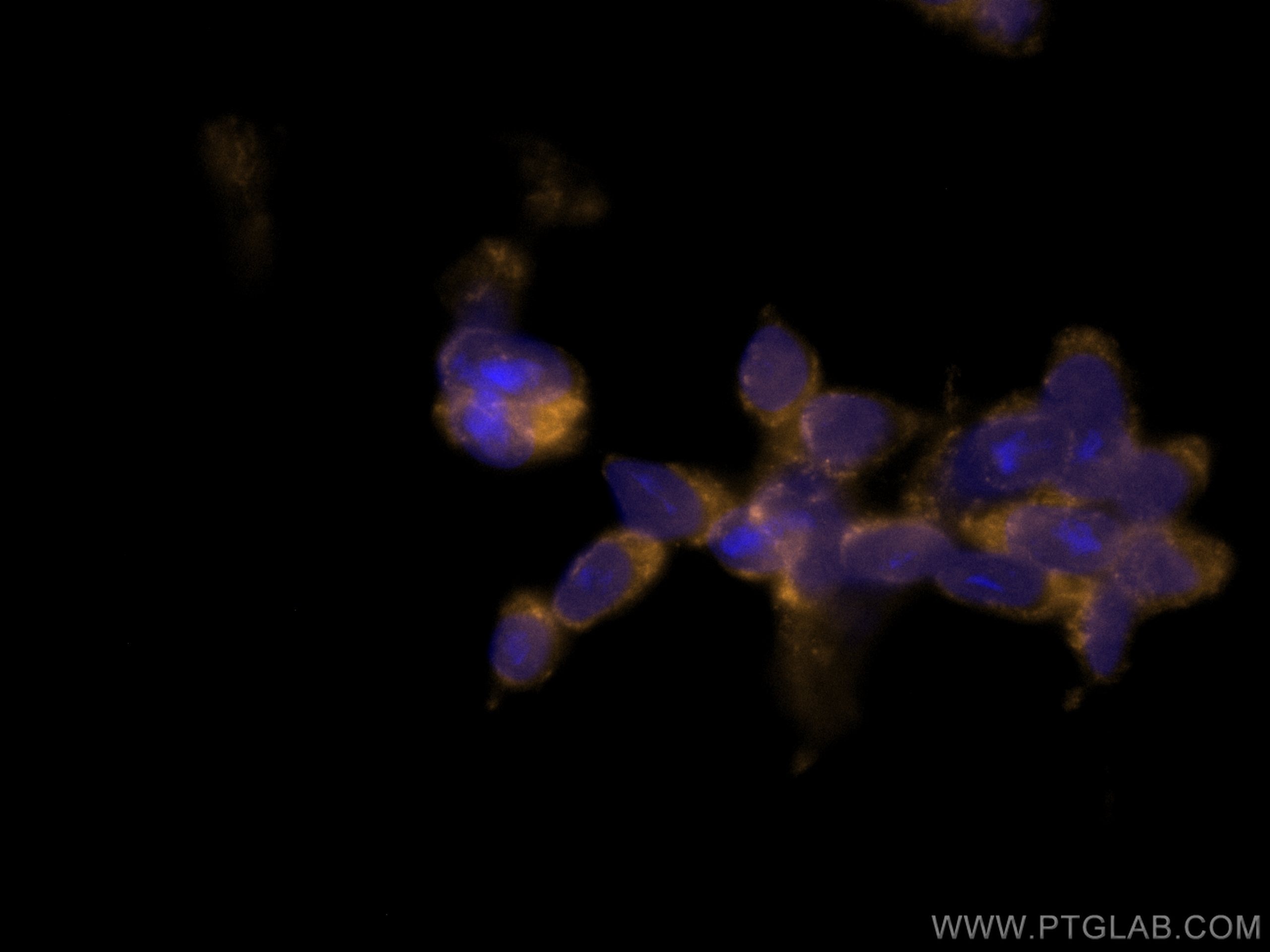 Immunofluorescence (IF) / fluorescent staining of SH-SY5Y cells using CoraLite®555-conjugated Calretinin Monoclonal anti (CL555-66496)