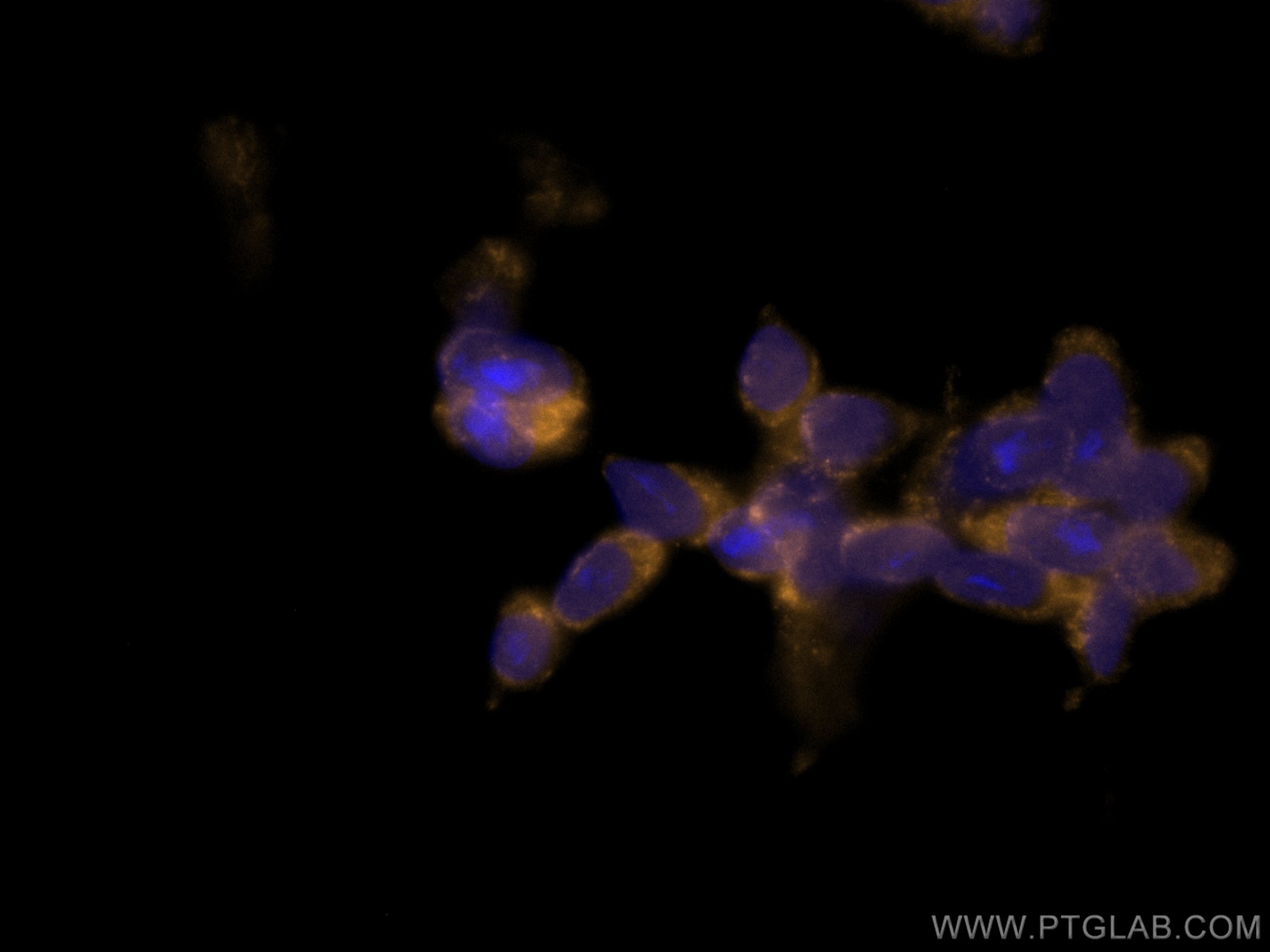 IF Staining of SH-SY5Y using CL555-66496