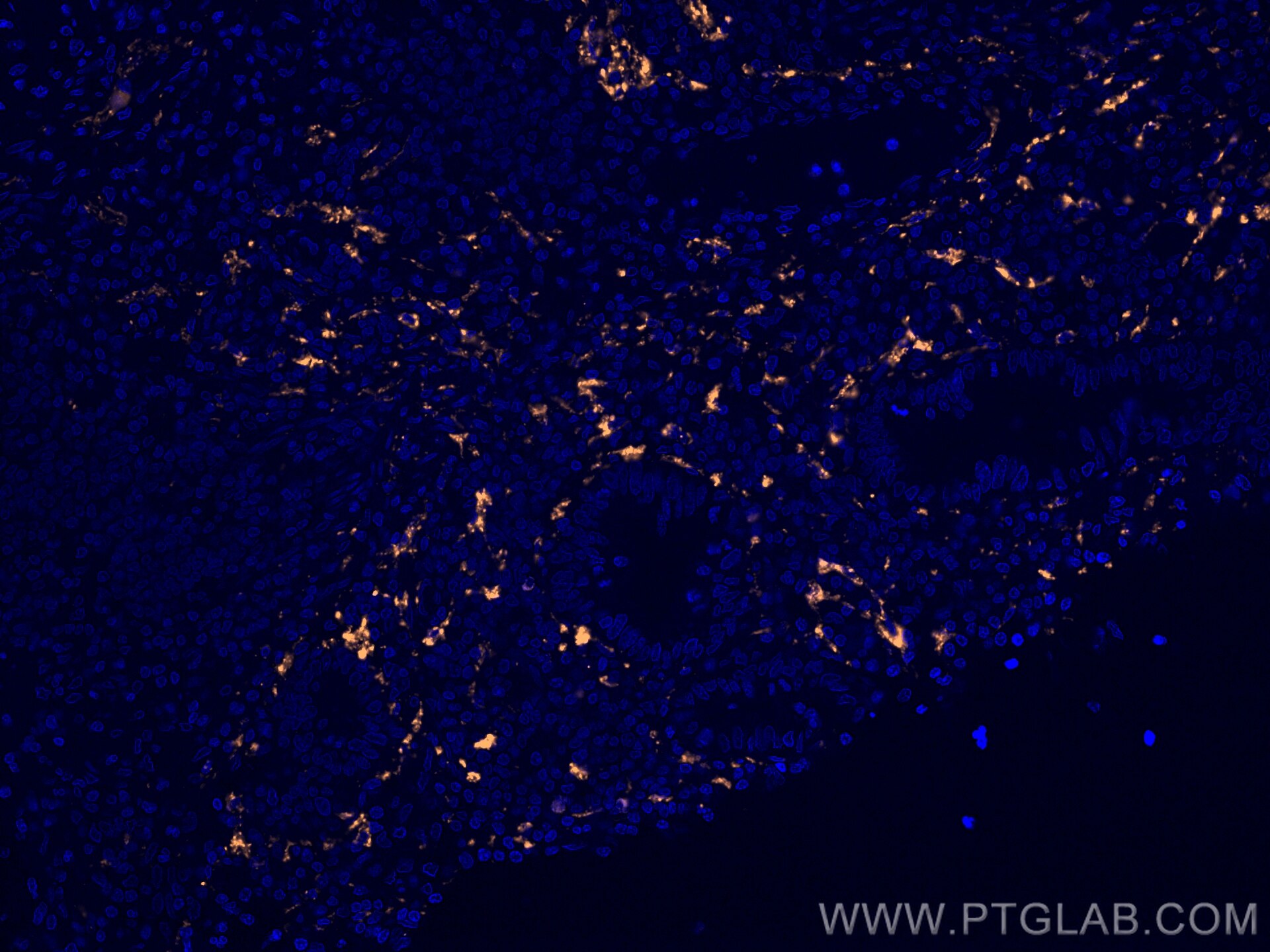 Immunofluorescence (IF) / fluorescent staining of human appendicitis tissue using CoraLite®555-conjugated Calretinin Monoclonal anti (CL555-66496)