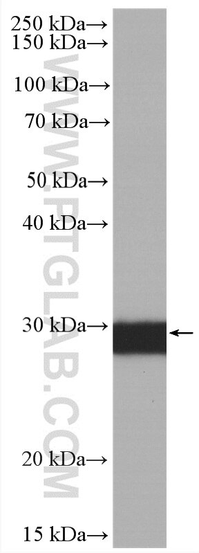 WB analysis of mouse brain using HRP-66496