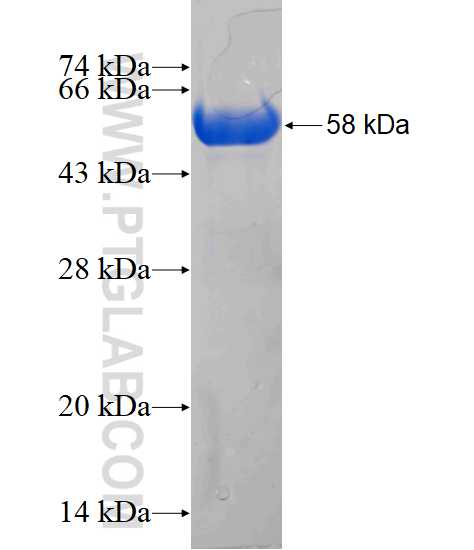 Calretinin fusion protein Ag2924 SDS-PAGE