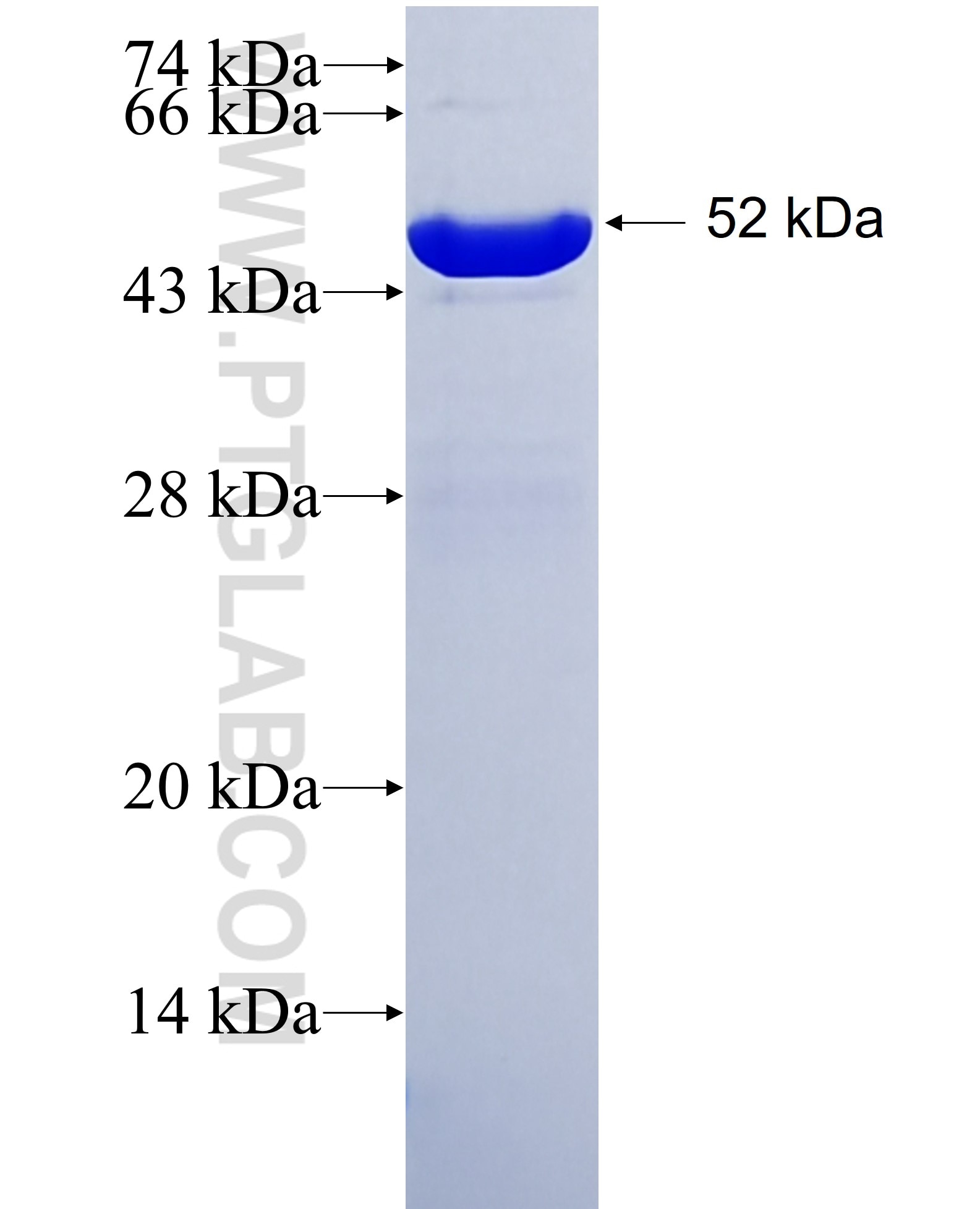 Calretinin fusion protein Ag2924 SDS-PAGE