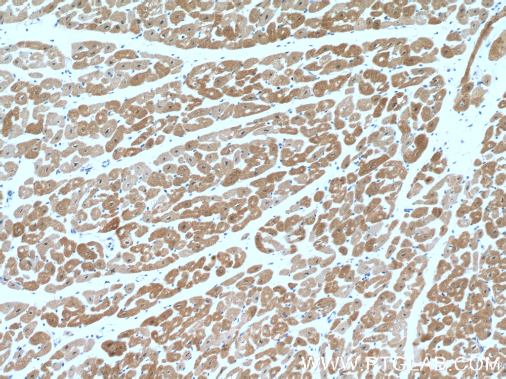 IHC staining of human heart using 27560-1-AP