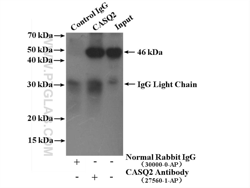 Immunoprecipitation (IP) experiment of mouse heart tissue using Calsequestrin 2 Polyclonal antibody (27560-1-AP)