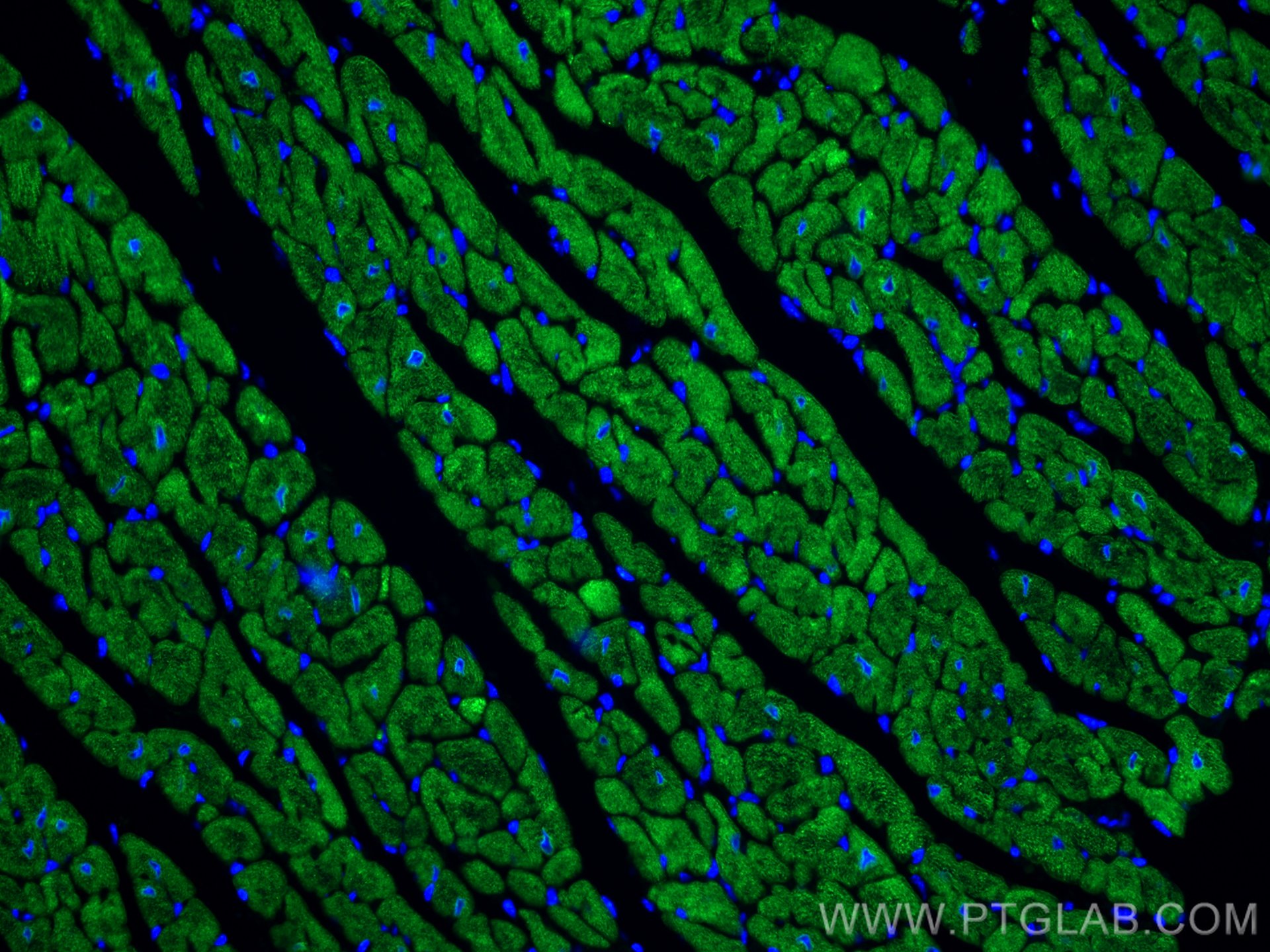 Immunofluorescence (IF) / fluorescent staining of mouse heart tissue using CoraLite® Plus 488-conjugated Calsequestrin 2 Mono (CL488-66419)