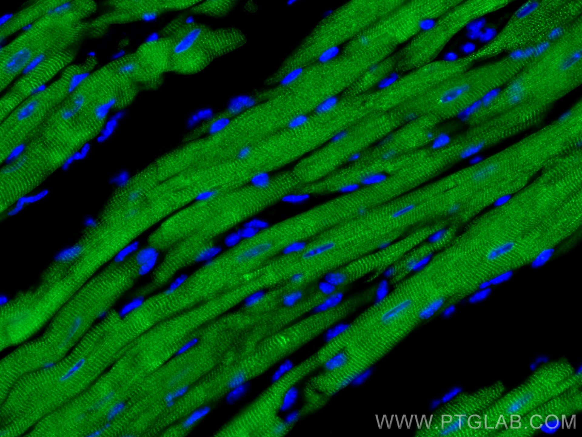 Immunofluorescence (IF) / fluorescent staining of mouse heart tissue using CoraLite® Plus 488-conjugated Calsequestrin 2 Mono (CL488-66419)