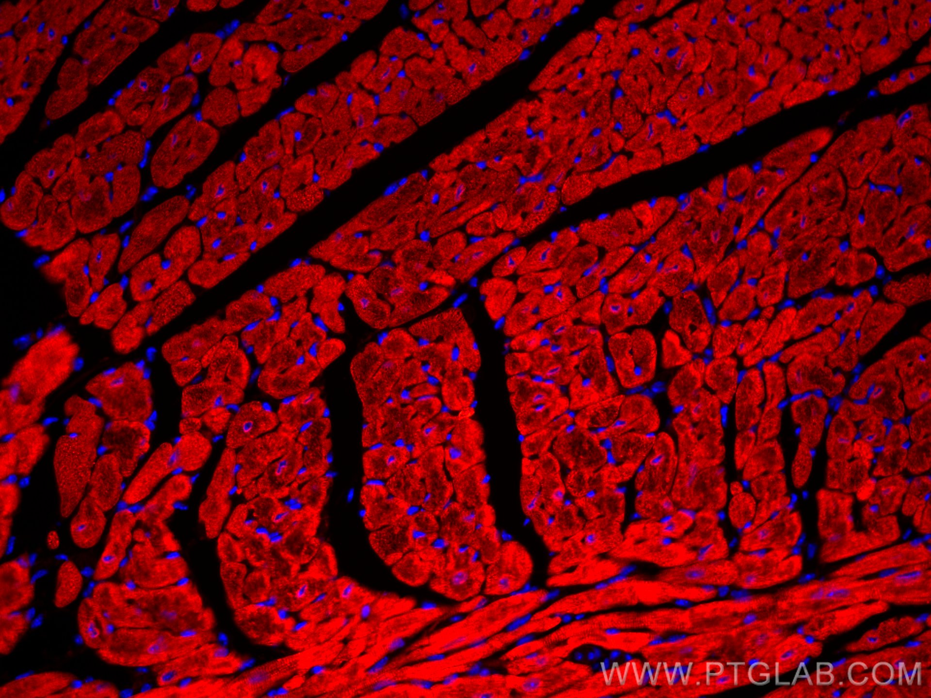 Immunofluorescence (IF) / fluorescent staining of mouse heart tissue using CoraLite®594-conjugated Calsequestrin 2 Monoclonal (CL594-66419)