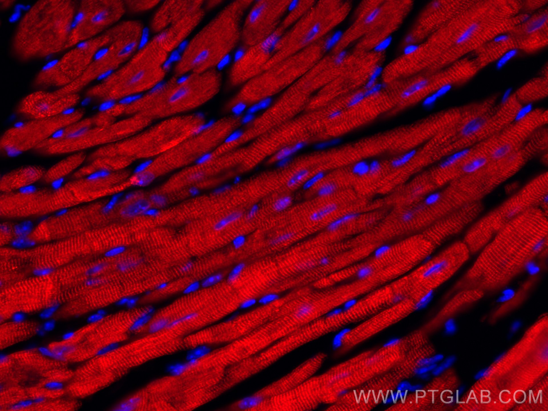 Immunofluorescence (IF) / fluorescent staining of mouse heart tissue using CoraLite®594-conjugated Calsequestrin 2 Monoclonal (CL594-66419)