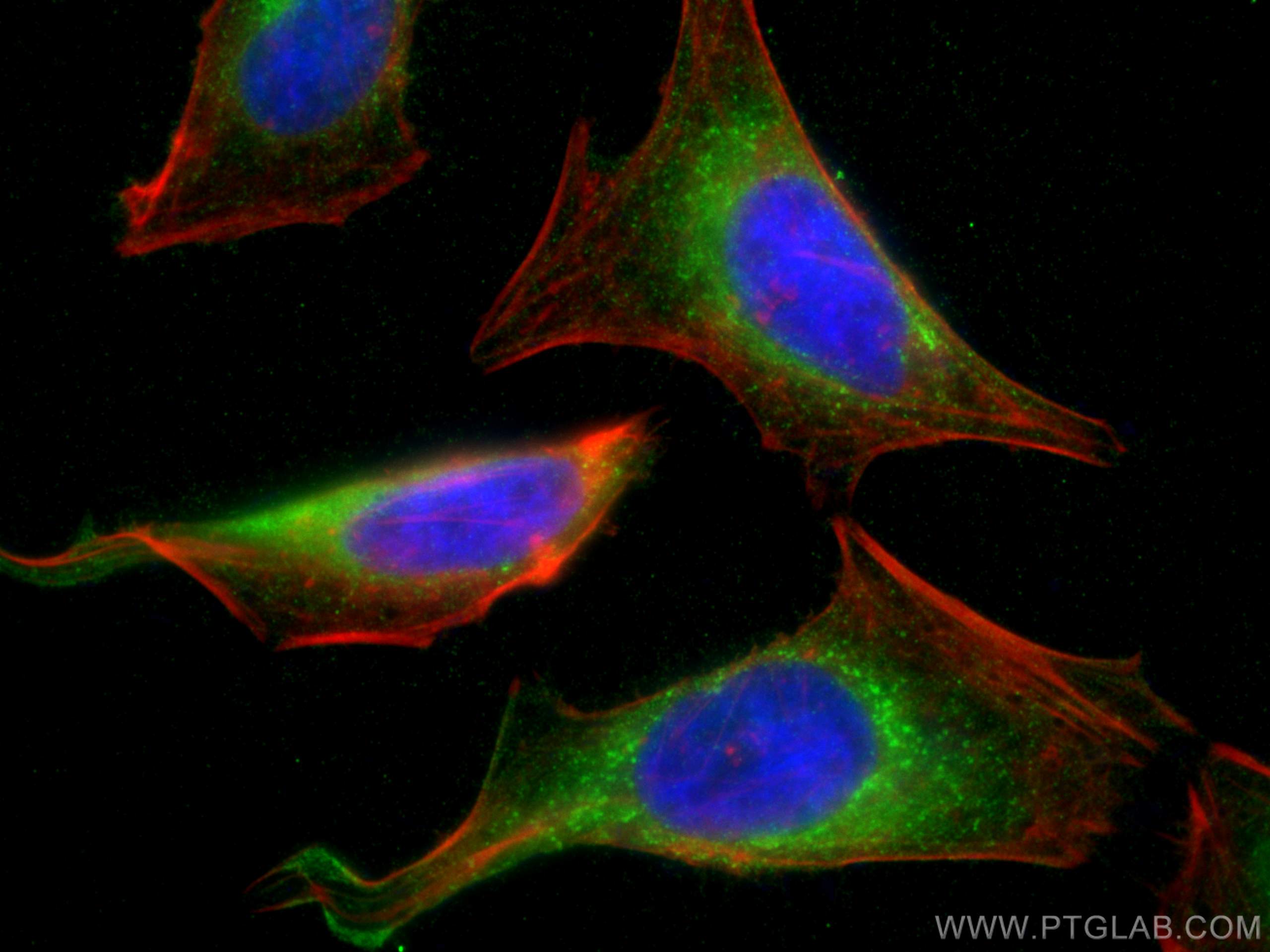 Immunofluorescence (IF) / fluorescent staining of HeLa cells using Calumenin Monoclonal antibody (67585-1-Ig)