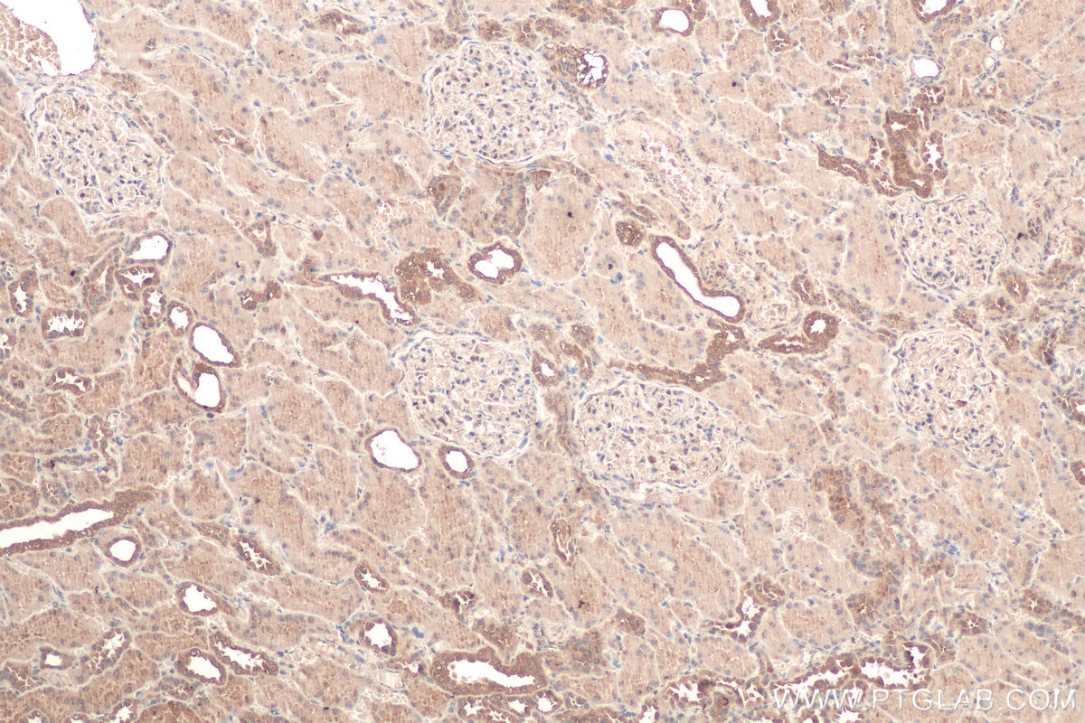 Immunohistochemistry (IHC) staining of human kidney tissue using Calumenin Monoclonal antibody (67585-1-Ig)